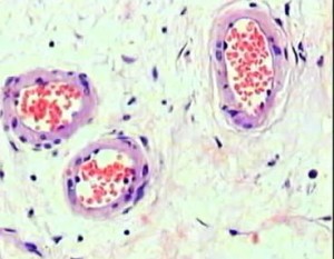 Tipos de celula, del tejido epitelial